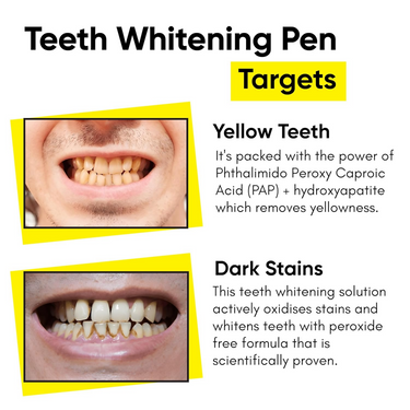 https://cdn.shopify.com/s/files/1/1857/6931/files/8NiScU12AL.png?v=1728631697